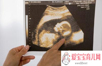 怀孕4-6个月应该注意什么怀孕4-6个月常见问题有哪些