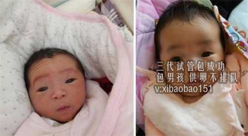 郑州捐卵价格表_第二代试管婴儿成功率费用是多少