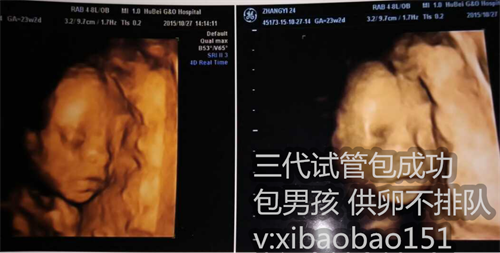 南京代怀孕诺贝尔,为什么医生不建议做试管婴儿呢？其中的心酸，或许只有过