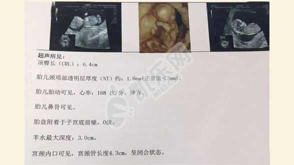 南京代怀孕机构哪家靠谱,云南借卵代怀机构,去公立医院做试管婴儿的流程是先