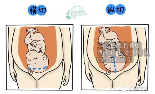 上海代怀男宝宝,内蒙古供卵代怀包男孩,想做试管婴儿龙凤胎,试管婴儿做龙凤胎
