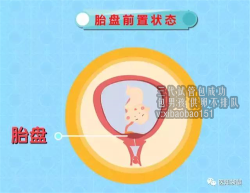 郑州专业的助孕包成功_试管婴儿成功率具体是多少?